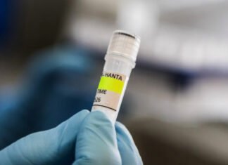 Los seis países con casos de hantavirus